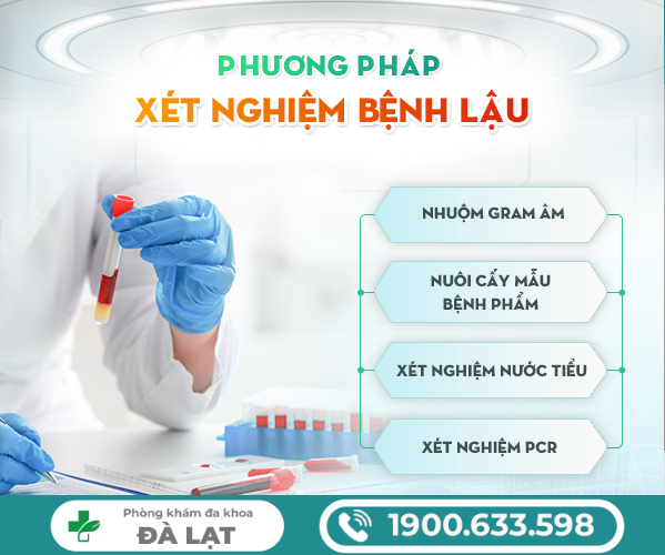 Hình ảnh minh họa